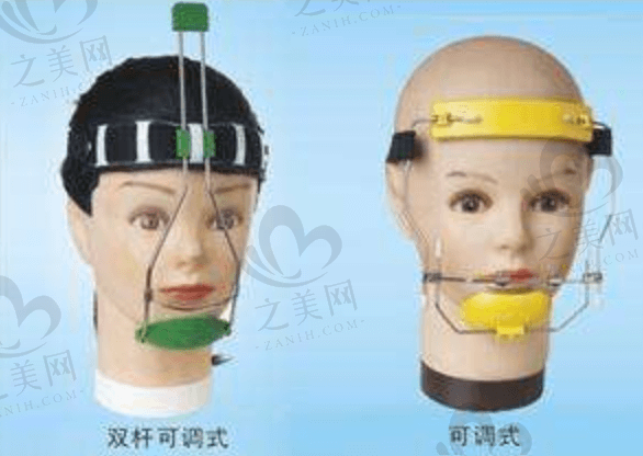 儿童地包天（反颌）面罩牵引器