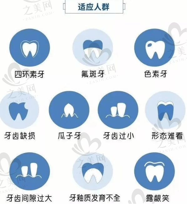 哪些牙齿通过做牙贴面来修复