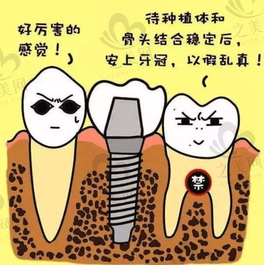慈溪鼎植口腔医院陈炳霖院长做种植牙技术怎么样？