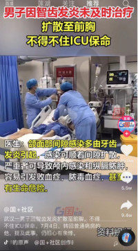 男子智齿发炎扩散胸部住进ICU