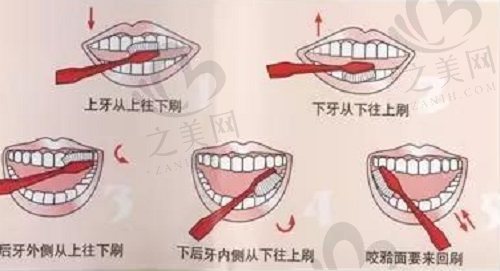 儿童正确刷牙方式