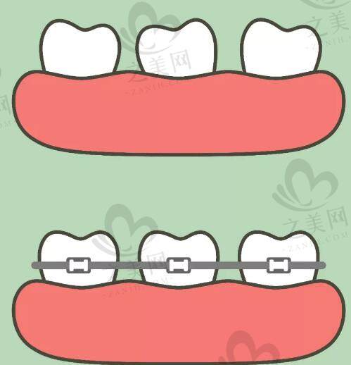 牙齿排列形状