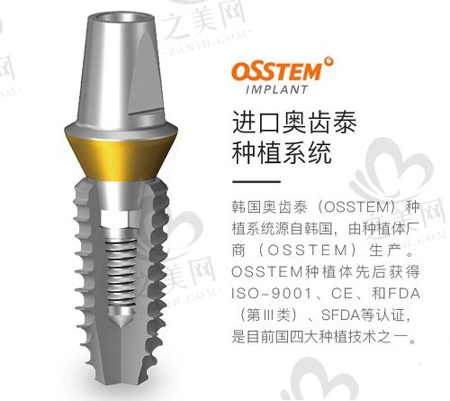韩国奥齿泰种植体