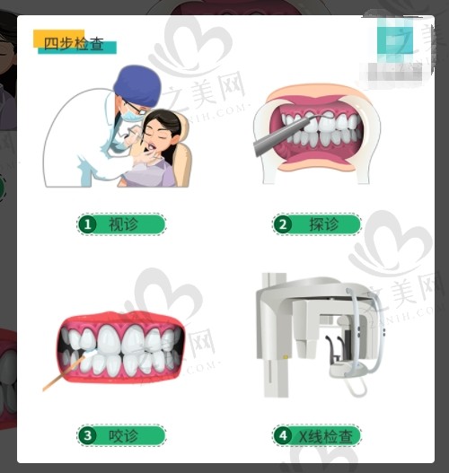 口腔四步检查