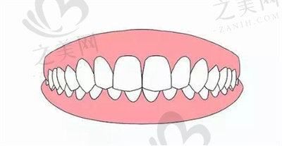 龅牙2