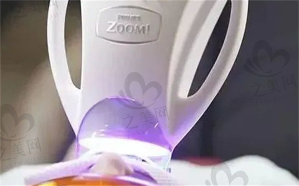 飞利浦zoom牙齿美白原理是啥?有副作用是真的吗(附价格)