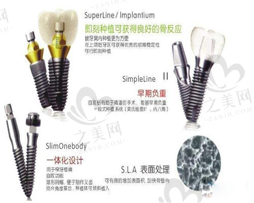 韩国登腾种植牙优势