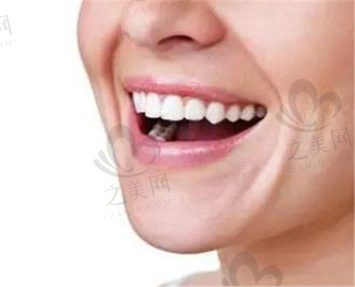 牙齿排列整齐的优势