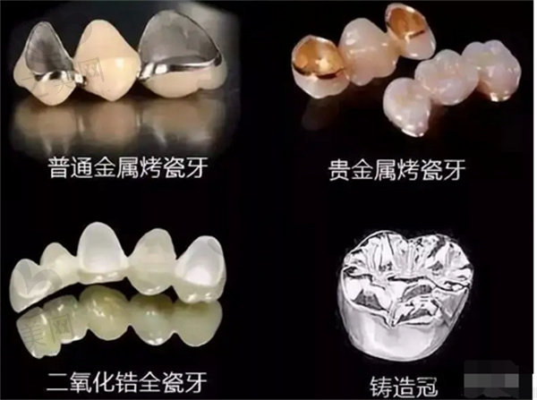 牙齿缺失一直不种有什么后果？