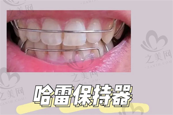 解答如何避免整牙反弹,及整牙后反弹如何补救