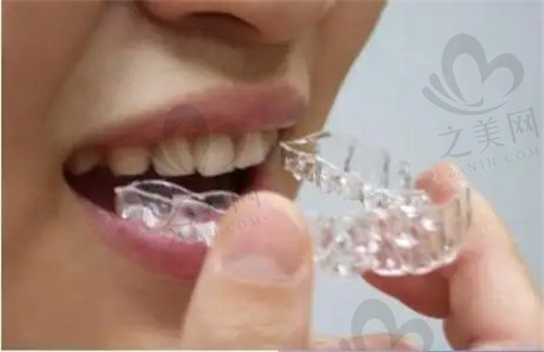牙齿矫正保持器戴多长时间呢