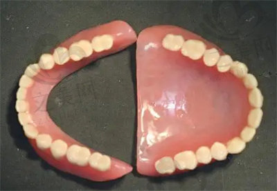 半口义齿修复的缺点
