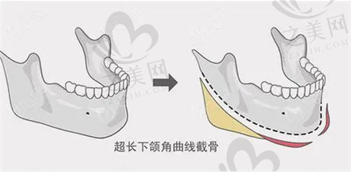 黄大勇医生怎么样