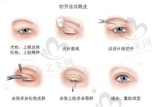 辽宁曙光整形医院做双眼皮怎么样