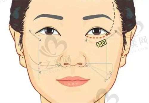 北京蒂凡妮整形醫(yī)院抗衰老怎么樣 北京蒂凡妮整形醫(yī)院抗衰老怎么樣