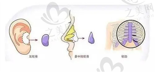 深圳宝丽李信锋做鼻子怎么样