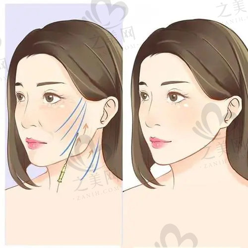 北京加減美醫(yī)療美容醫(yī)院拉皮手術(shù)醫(yī)生排名 北京加減美醫(yī)療美容醫(yī)院拉皮手術(shù)醫(yī)生排名