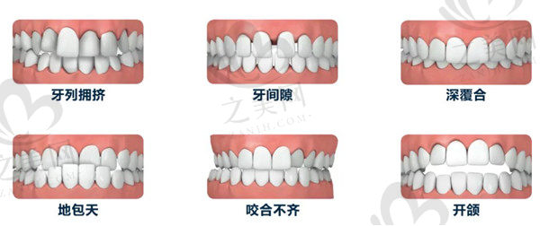 我选择的达州医大口腔医院特色项目