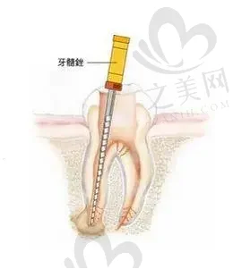 2023贵州全瓷基台一体冠排名前十的口腔医院,看看哪家便宜又好