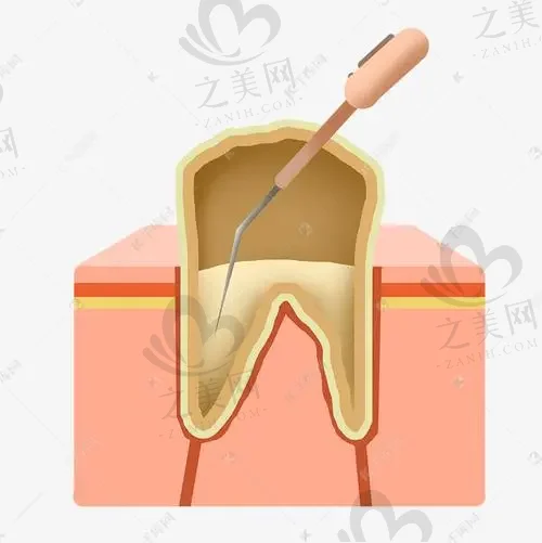 西安隐形矫正深覆合正规口腔医院排名