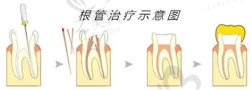 郑州德国Camlog卡姆洛种植牙齿科医院