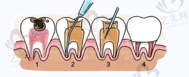 2023温州牙齿修复体推荐前十位牙科医院(温州奥齿泰口腔医院医院top口碑在线)