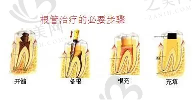 2023济南牙齿种植医院排名前十出炉,济南种植牙哪个医院好一目了然