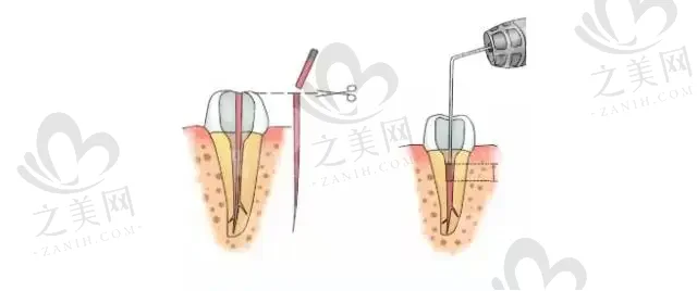 2023河北烤瓷牙医院排名top10强强榜(河北医科大学第二医院很突出）