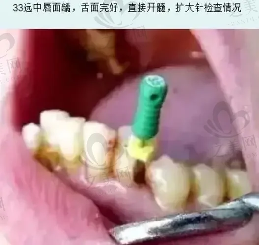 2023南京根管治疗哪家医院好(排名前十中南京康贝佳口腔很耀眼)