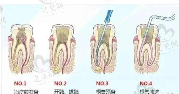 2023北京牙齿修复正规齿科医院榜单前10强,都是烤/全瓷牙修好的医院!