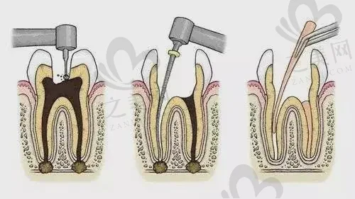 无锡爱思特春天口腔医院