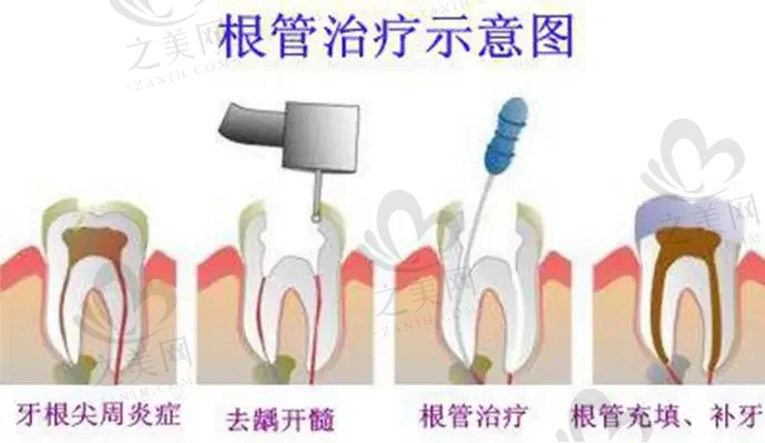 公布杭州十大高性价比口腔医院排名，哪家医院固定桥假牙便宜又好