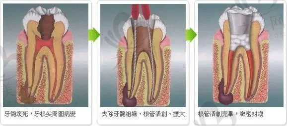 北京上牙半口假牙固定排行榜前十牙科医院