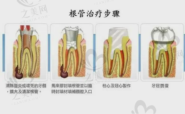 2023青岛纳米牙齿贴面哪家好?瑞泰口腔|拜博口腔不贵口碑好