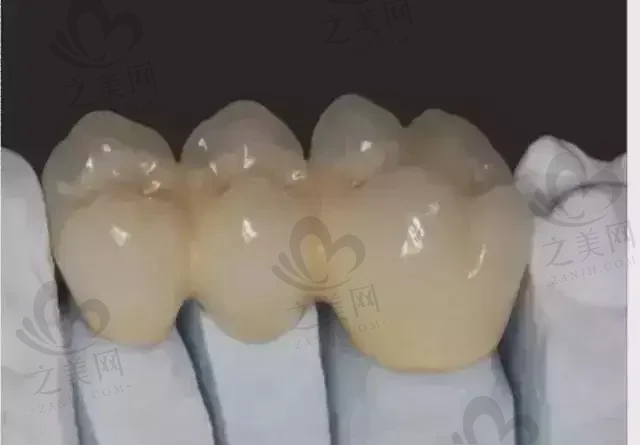 2023哈尔滨牙齿黑三角修复手术牙科医院在榜名单前十位