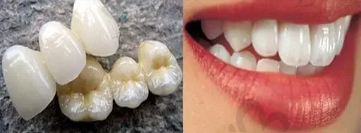 台州牙齿美白在榜前十医院:台州医院口腔科|牙博士|路桥上榜
