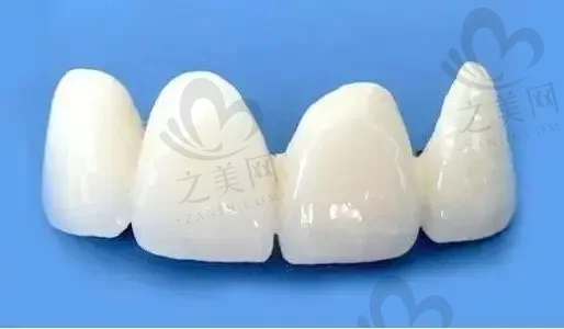 2023郑州牙贴面医院排名榜前十出炉,全是正规口碑牙科附价目表