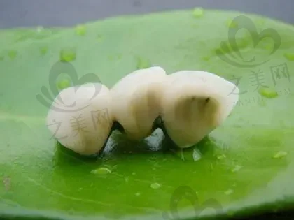 上海All-on-4半口种植牙正规医院排行榜前十:仁济|长征|九医院上榜