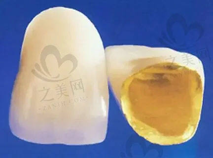 2023泉州萎缩性牙龈牙科医院上榜前十(泉州正雅口腔医院年度黑马机构出炉)