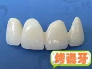2023深圳口腔种植牙齿正规牙科医院评分十强(深圳科易白口腔诊所带来不一样的选择和体验)