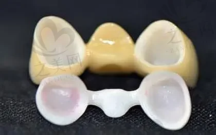 上海牙槽骨内侧凸起口腔医院综合实力排名