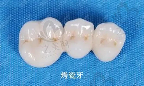 2023温州即刻修复牙齿口腔医院前十位口碑榜(温州百佳东方整形口腔科概况、技术、口碑分析)