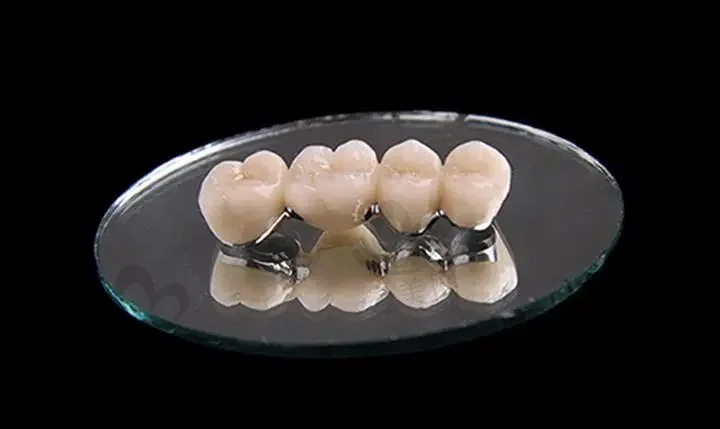 2023成都种植体牙周组织口腔医院口碑10强(成都茁悦齿科技术特点解析)