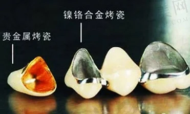 2023宁波牙根拔除术正规口腔医院排行榜前十强(宁波牙壹家口腔门诊上榜优势呈现~)