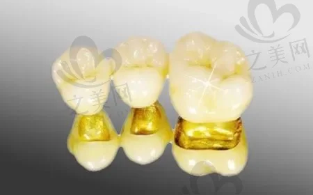 西安牙槽骨吸收口腔医院在榜名单前10强(西安大一附院口腔科技术确实好)