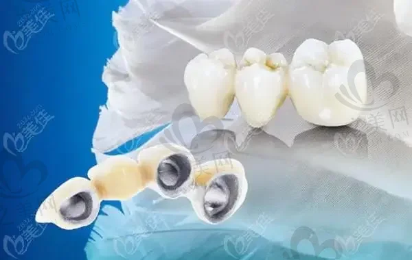 2023重庆牙龈萎缩手术修复牙科医院评价前十(重庆成佳牙博士口腔医院口碑与实力的选择)