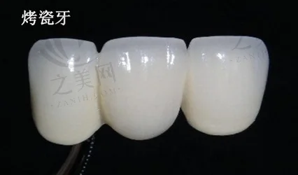 合肥牙齿矫正门牙突口腔医院榜单前十(第二人民医院牙科有看头)