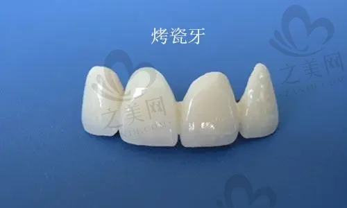 上海龋齿牙冠齿科医院前十名