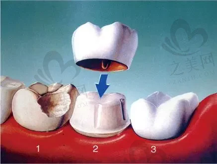 2023南京激光牙齿美白口腔美容医院综合实力排行榜(南京极橙儿童齿科是出名靠谱的医院)