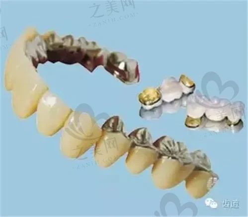 新疆超薄瓷牙贴面医院排名榜top10强(这些口腔科靠谱又有名)